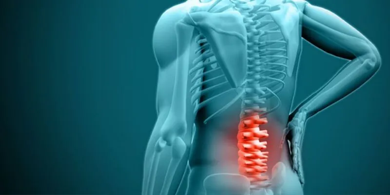 điều trị thoát vị đĩa đệm