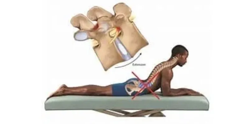 Đĩa Đệm: Vai Trò Quan Trọng và Cách Bảo Vệ Cột Sống