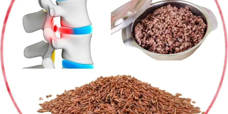 điều trị Thoát vị đĩa đệm bằng gạo lứ
